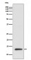 Anti-ROC1 Monoclonal Antibody